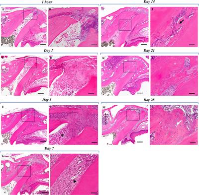 Periodontal Ligament Cells Are Involved in the Formation of Intracanal Cementum-Like Tissue After Regenerative Endodontic Procedures: A Mouse in situ Model